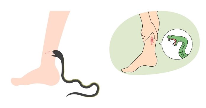 What does it mean when your snake bites you on your leg?