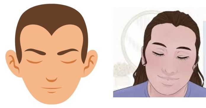 How common is a widows peak?