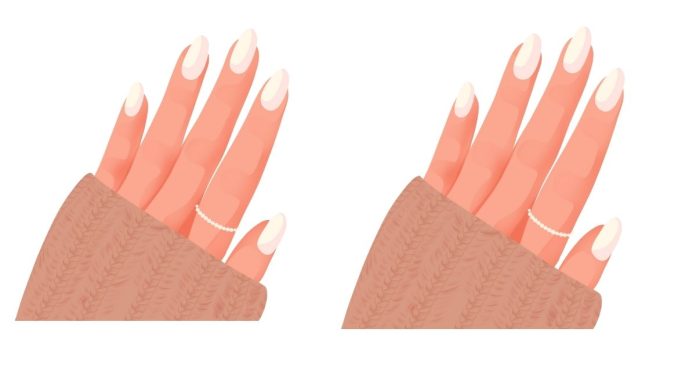 Why are some people's nail tips white?